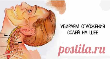 Избавляемся от солей на шее: просто и эффективно! - Образованная Сова