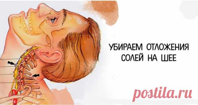 Избавляемся от солей на шее: просто и эффективно! - Образованная Сова