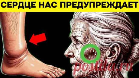 Сердце нас предупреждает: 11 признаков сердечного приступа, которые не стоит игнорировать | Игорь Ботоговский | Дзен