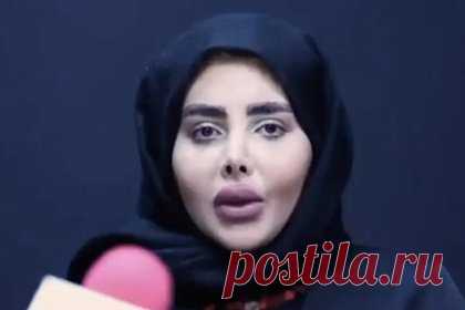 «Иранская Анджелина Джоли» показала настоящее лицо без фотошопа. Жительница Ирана Сахар Табар, прославившаяся внешностью, схожей с жуткой версией Анджелины Джоли, показала настоящее лицо после освобождения из тюрьмы. Блогерша появилась в эфире местного телевидения, представ перед репортерами в хиджабе. На размещенных кадрах видно, что на самом деле лицо девушки не деформировано.