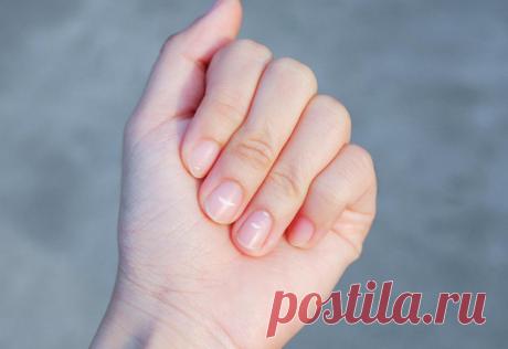 Почему появляются белые пятна на ногтях и что с этим делать &amp;raquo; Женский Мир