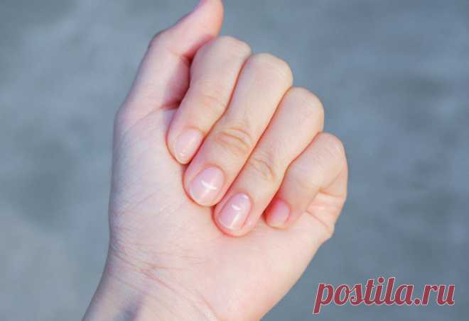 Почему появляются белые пятна на ногтях и что с этим делать &raquo; Женский Мир