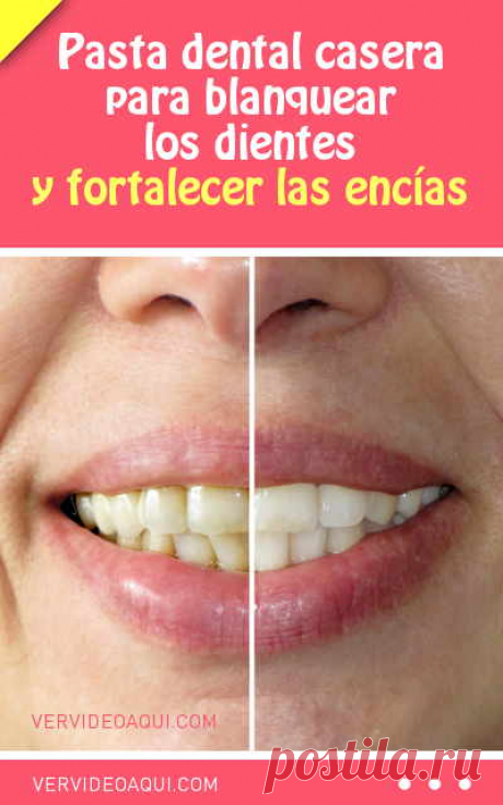 Blanqueador de dientes casero. Para blanquear los dientes y fortalecer las encías