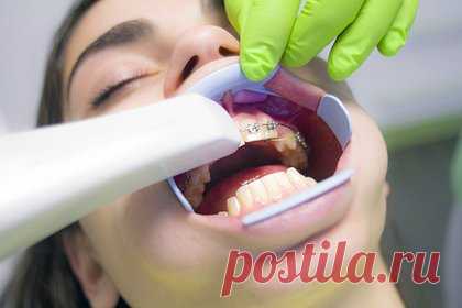 Стоматолог назвала семь способов уговорить ребенка пойти к врачу. Стоматолог Егана Маруфиди рассказала, как можно уговорить ребенка пойти к зубному врачу, если он до ужаса боится этих визитов. Она посоветовала не врать и не приукрашивать. Лучше рассказать, что лечение зубов может вызывать неприятные ощущения, но они длятся не более нескольких минут.