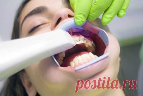 Стоматолог назвала семь способов уговорить ребенка пойти к врачу. Стоматолог Егана Маруфиди рассказала, как можно уговорить ребенка пойти к зубному врачу, если он до ужаса боится этих визитов. Она посоветовала не врать и не приукрашивать. Лучше рассказать, что лечение зубов может вызывать неприятные ощущения, но они длятся не более нескольких минут.