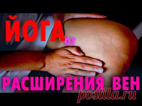 Йога при варикозном расширении вен