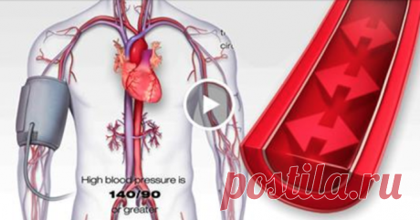 Избавься от высокого кровяного давления всего за 10 секунд! Используй эти 3 простых средства!