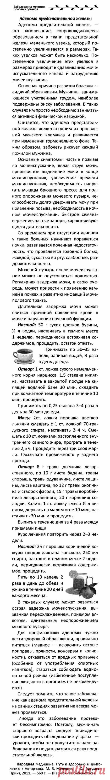 Аденома предстательной железы