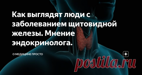 Как выглядят люди с заболеванием щитовидной железы. Мнение эндокринолога. Сегодня обсудим самое частое заболевание эндокринной системы-гипотиреоз. Это состояние, при котором щитовидная железа теряет способность вырабатывать достаточное количество тиреоидных гормонов (Т4, Т3). Заболевание настолько распространено, что, наверное, не найдется ни одной семьи ,которую не коснулась эта хворь. Я знаю это, потому что вижу таких людей на приёме, вижу среди своих подруг и