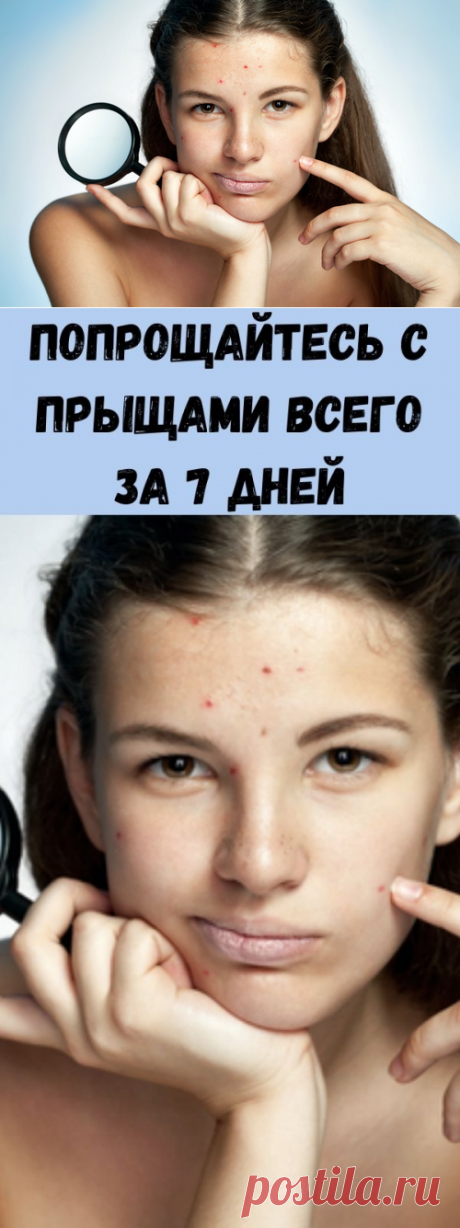 Попрощайтесь с прыщами всего за 7 дней - Полезные советы красоты