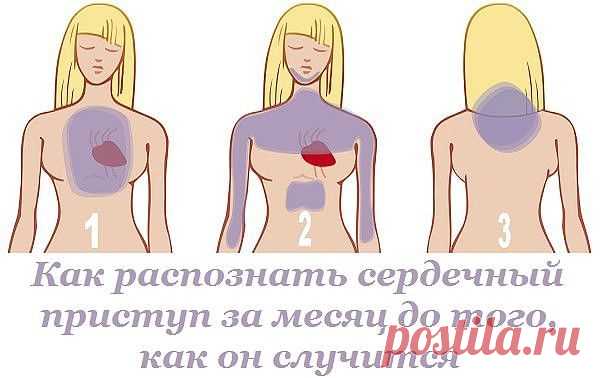 Как распознать сердечный приступ за месяц до того, как он случится