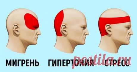 Как избавится от головной боли без таблеток за 5 минут