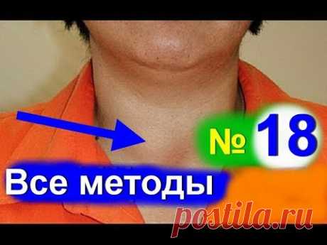 Лечение щитовидной железы! Узловой зоб. Как лечить щитовидку народными средствами №18| #зоб #edblack
