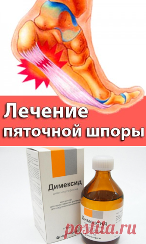 Пяточная шпора причины, симптомы и лечение в домашних условиях