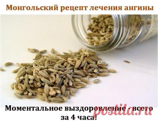Монгольский рецепт лечения ангины.
Моментальное выздоровление - всего за 4 часа!
Рецепт.
*
 0,5 стакана размолотых в кофемолке зернышек тмина залить 1 стаканом 
воды и кипятить 15 минут. Получается вязкая, напоминающая кофейную гущу,
 масса.
* Процеживаем через ситечко, разбавляем 1/4 стакана воды и
 снова доводим до кипения. Снимаем с огня, добавляем в отвар 1 ст. ложку
 коньяка. Лекарство готово!
* Пить каждые 30 мин по 1 ст. ложке.
Уже
 через 2 часа боль в горле проходит, глотать станови
