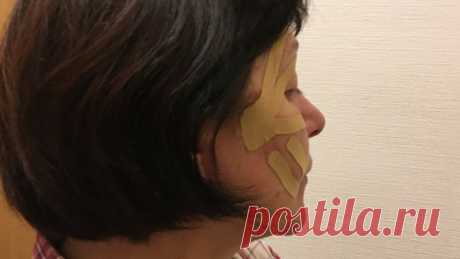 Купила лифтинг тейпы для подтяжки лица. Первое ощущение - зря потратила 600 рублей