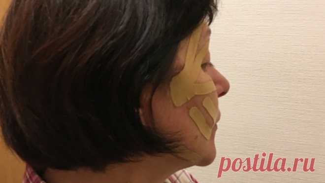 Купила лифтинг тейпы для подтяжки лица. Первое ощущение - зря потратила 600 рублей