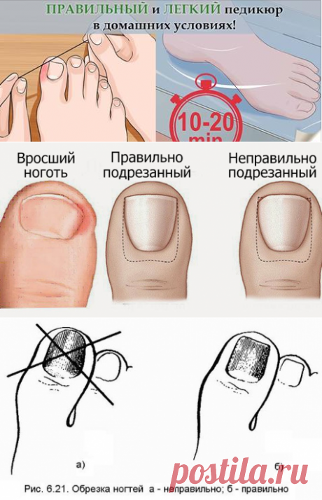 «Золотые» правила БЕЗУПРЕЧНОГО ПЕДИКЮРА в домашних условиях! Лучше салонной процедуры!
