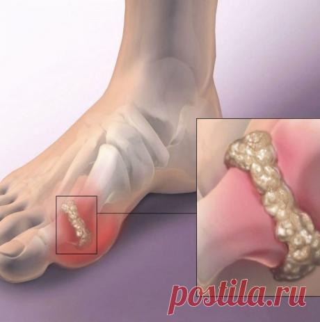 Овощи, которые помогут снизить показатель мочевой кислоты в организме / Будьте здоровы