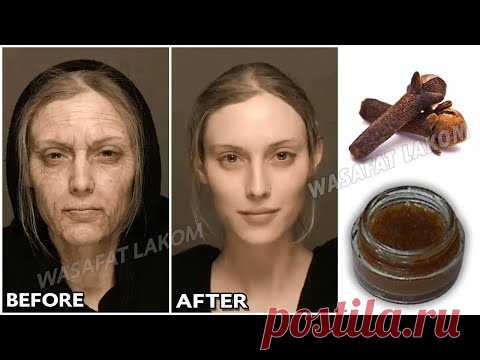 Смешайте гвоздику с водой, чтобы выглядеть на 10 лет моложе своего возраста.🌱 Натуральный ботокс.