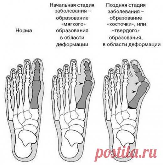 (112) Pinterest