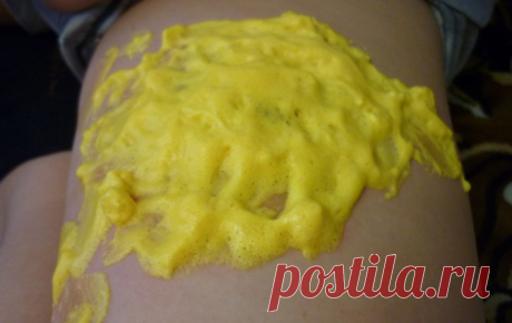 Волшебная мазь от мозолей и натоптышей - Упражнения и похудение Применять средство до тех пор, пока не исчезнут мозоли. Необходимо смешать небольшой кусочек хозяйственного мыла (приблизительно 20 грамм), 50 грамм репчатого лука, столовую ложку сметаны и столовую ложку натурального меда. Измельчить и перемешать все компоненты. Чтобы избавиться от мозолей, необходимо наложить состав на место мозоли, укутать тканью или бинтом и оставить на ночь, утром смыть …