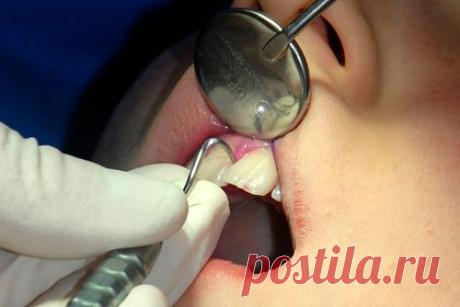 Врач назвал причины кровоточивости десен и способы избежать ее. Стоматолог Владимир Лосев назвал причины кровоточивости десен и назвал способы предотвратить ее. Врач призвал тщательно ухаживать за зубами мудрости и теми зубами, на которых есть коронки с неровными или острыми краями. По словам стоматолога, воспаленные десны вызывают не только боль, но и эмоциональный дискомфорт.