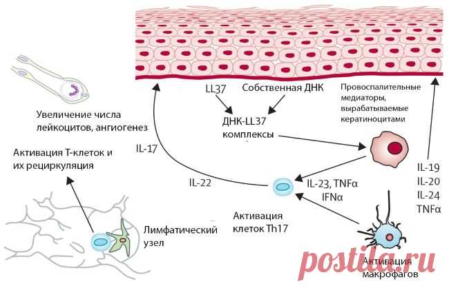 Причины возникновения псориаза у взрослых на теле, психосоматика появления псориаза