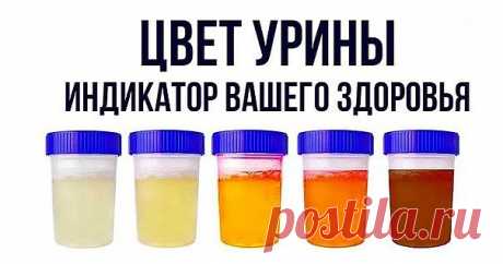 Цвет урины – индикатор вашего здоровья
Хотя многие люди не знают об этом, моча может рассказать нам много о нашем теле. 
Это может быть индикатором различных проблем со здоровьем, и ее цвет, запах или частота могут помочь нам понять, что что-то не так с нашим здоровьем.
Продолжение на сайте: https://moy-znahar.ru/620/Analiz_mochi_kakoj_dolzhna_bytq_mocha_v_norme_i_pri_patologiyah/