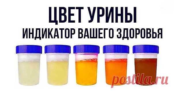 Цвет урины – индикатор вашего здоровья
Хотя многие люди не знают об этом, моча может рассказать нам много о нашем теле. 
Это может быть индикатором различных проблем со здоровьем, и ее цвет, запах или частота могут помочь нам понять, что что-то не так с нашим здоровьем.
Продолжение на сайте: https://moy-znahar.ru/620/Analiz_mochi_kakoj_dolzhna_bytq_mocha_v_norme_i_pri_patologiyah/