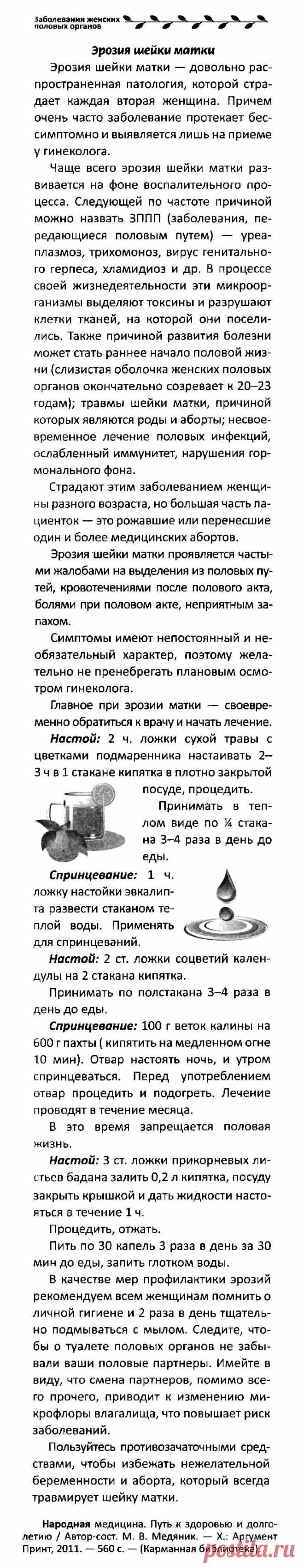 Эрозия шейки матки