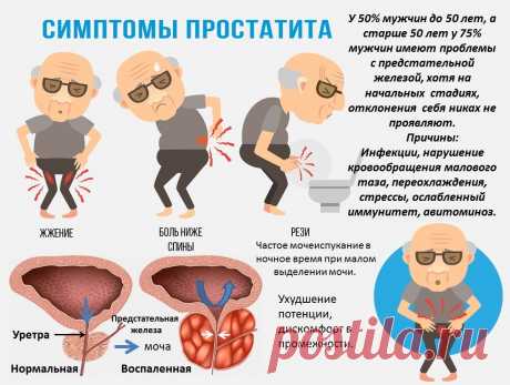 Симптомы простатита