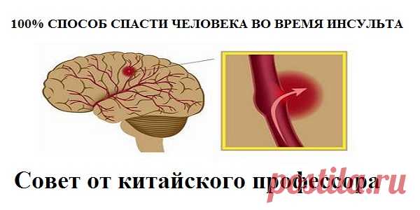 100% СПОСОБ СПАСТИ ЧЕЛОВЕКА ВО ВРЕМЯ ИНСУЛЬТА ! Совет от китайского профессора. Держите в доме шприц или иглу. - Важное