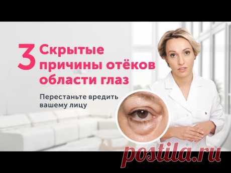 ОТЁКИ И МЕШКИ под глазами: НЕОЖИДАННЫЕ причины и одно полезное упражнение