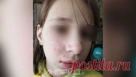 &quot;Избили кулаками&quot;: на школьницу напал мальчик, которого она задела рукой. В Ульяновске местная жительница пожаловалась, что ее дочь избил ученик школы, которую посещает девочка, предположительно, ребенок приезжих. Об этом сообщает Telegram-канал &quot;Инсайд Ульяновск - Оперативный новостной канал Ульяновской ...
