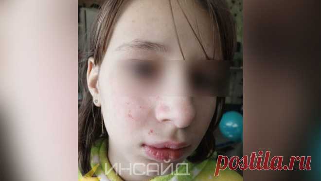 "Избили кулаками": на школьницу напал мальчик, которого она задела рукой. В Ульяновске местная жительница пожаловалась, что ее дочь избил ученик школы, которую посещает девочка, предположительно, ребенок приезжих. Об этом сообщает Telegram-канал "Инсайд Ульяновск - Оперативный новостной канал Ульяновской ...
