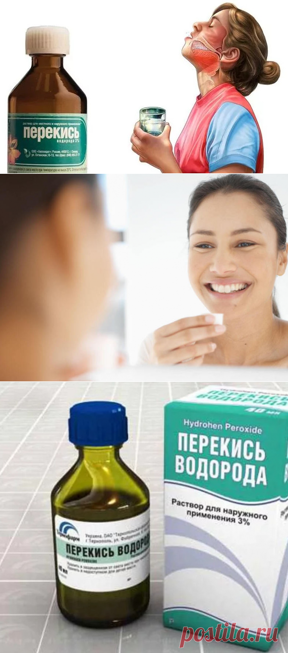 Перекись водорода: 11 способов использования в домашних условиях, о которых вы не знали