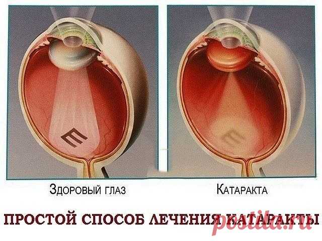 (46) Одноклассники