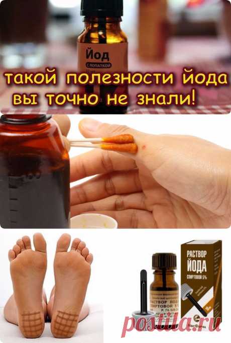 Как с помощью йода помочь себе при различных болезнях - interesno.win