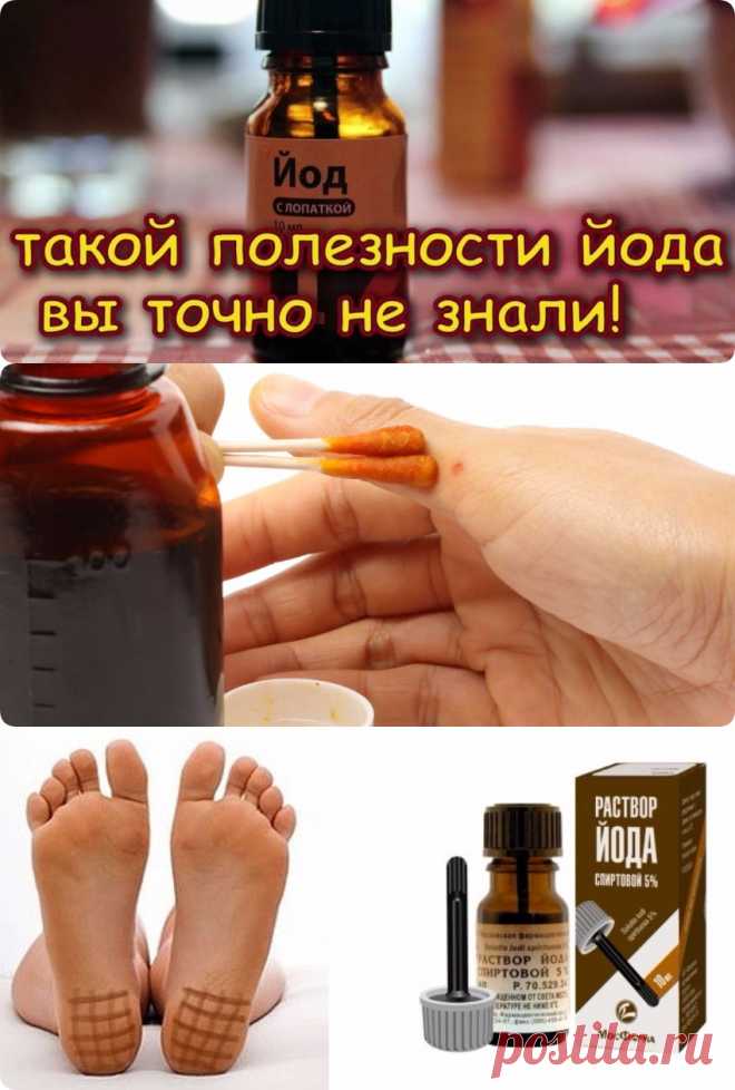 Как с помощью йода помочь себе при различных болезнях - interesno.win