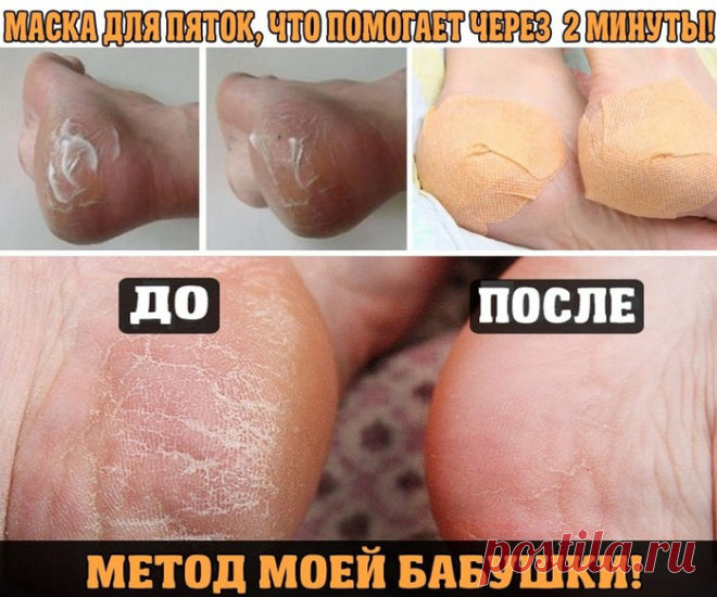 Здоровье >МАСКА ДЛЯ ПЯТОК