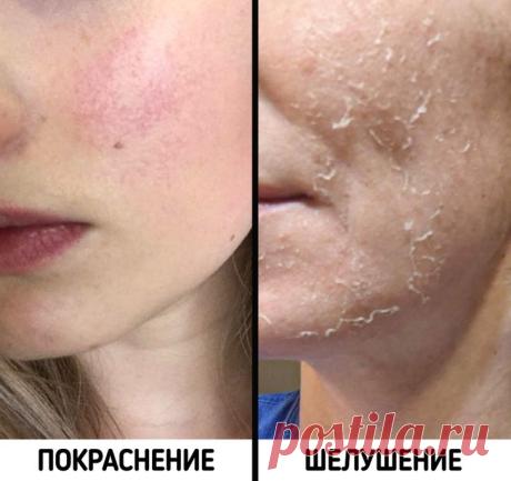 Разрекламированные косметические процедуры, об обратной стороне которых тактично промолчат в салонах красоты Почти все современные салонные процедуры имеют свою темную сторону, о которой нам никто не говорит. Поэтому осознать всю опасность разрекламированных услуг зачастую можно только на собственном печальном опыте.