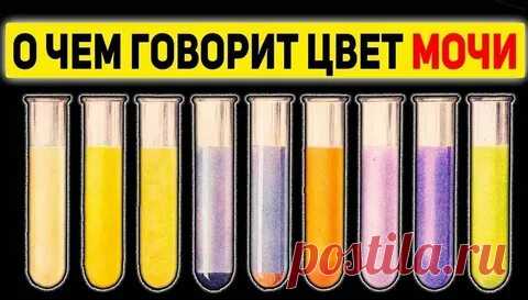 ВСЕ БОЛЕЗНИ ПО ЦВЕТУ МОЧИ: 2 тыс изображений найдено в Яндекс Картинках