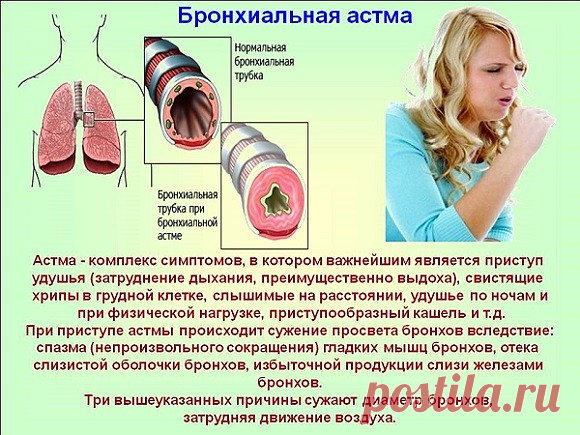 Десять вдохов и выдохов.
Поделюсь с читателями упражнением, снимающим спазмы бронхов, 
облегчающим приступы астмы и прочищающим носовые проходы. С помощью 
него мне удалось добиться облегчения состояния при бронхиальной астме, 
которой страдаю.