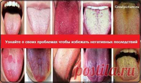 Язык — зеркало организма. Узнайте о своих проблемах, чтобы избежать негативных последствий 
 
Язык — уникальная часть тела, которая так необходима каждому из нас. С его помощью мы общаемся, употребляем пищу, поддерживаем здоровье полости рта и даже можем узнать о состоянии всего организма. …