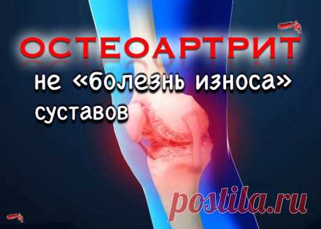 Остеоартрит - это не «болезнь износа» суставов Мы рассчитываем на существенный прогресс фармакотерапии остеоартрита уже в ближайшие годы Профессор А. М. Лила является членом президиума Ассоциации ревматологов России, вице-президентом Ассоциации терапевтов Санкт-Петербурга, членом президиума Научного общества терапевтов Санкт-Петербурга им...