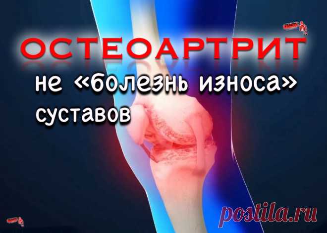 Остеоартрит - это не «болезнь износа» суставов Мы рассчитываем на существенный прогресс фармакотерапии остеоартрита уже в ближайшие годы Профессор А. М. Лила является членом президиума Ассоциации ревматологов России, вице-президентом Ассоциации терапевтов Санкт-Петербурга, членом президиума Научного общества терапевтов Санкт-Петербурга им...