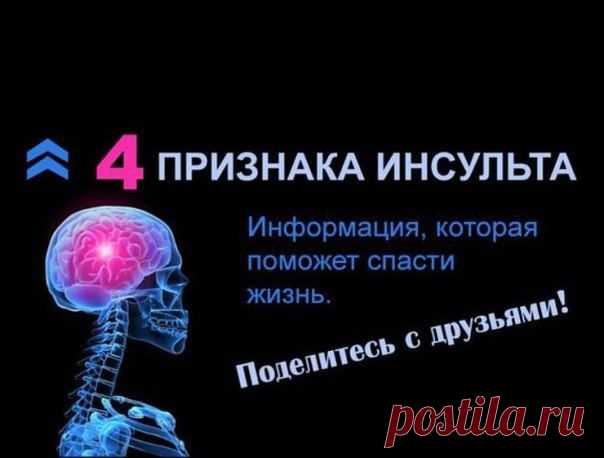 ПРИЗНАКИ ИНСУЛЬТА
