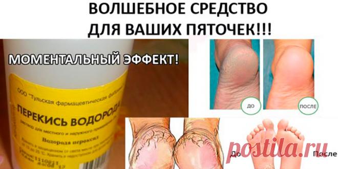 КОПЕЕЧНОЕ СРЕДСТВО ДЛЯ УХОДА ЗА ПЯТКАМИ | Полезные советы!