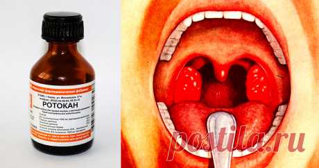 Моментальная подмога при ангине — именно так теперь лечу внуков!
Такой способ лечения ангины узнала от одного прекрасного доктора с огромным стажем работы. Рецепт для меня стал просто спасительным, теперь горло лечим только так. Смешиваю по 2 ч. ложки Ротокана (можно купить в аптеке) с касторовым маслом и раствором люголя. Ротокан — это смесь настоек ромашки, тысячелистника и календулы. Наматываю на указательный палец бинт, смачиваю […]
Читай дальше на сайте. Жми подробнее ➡